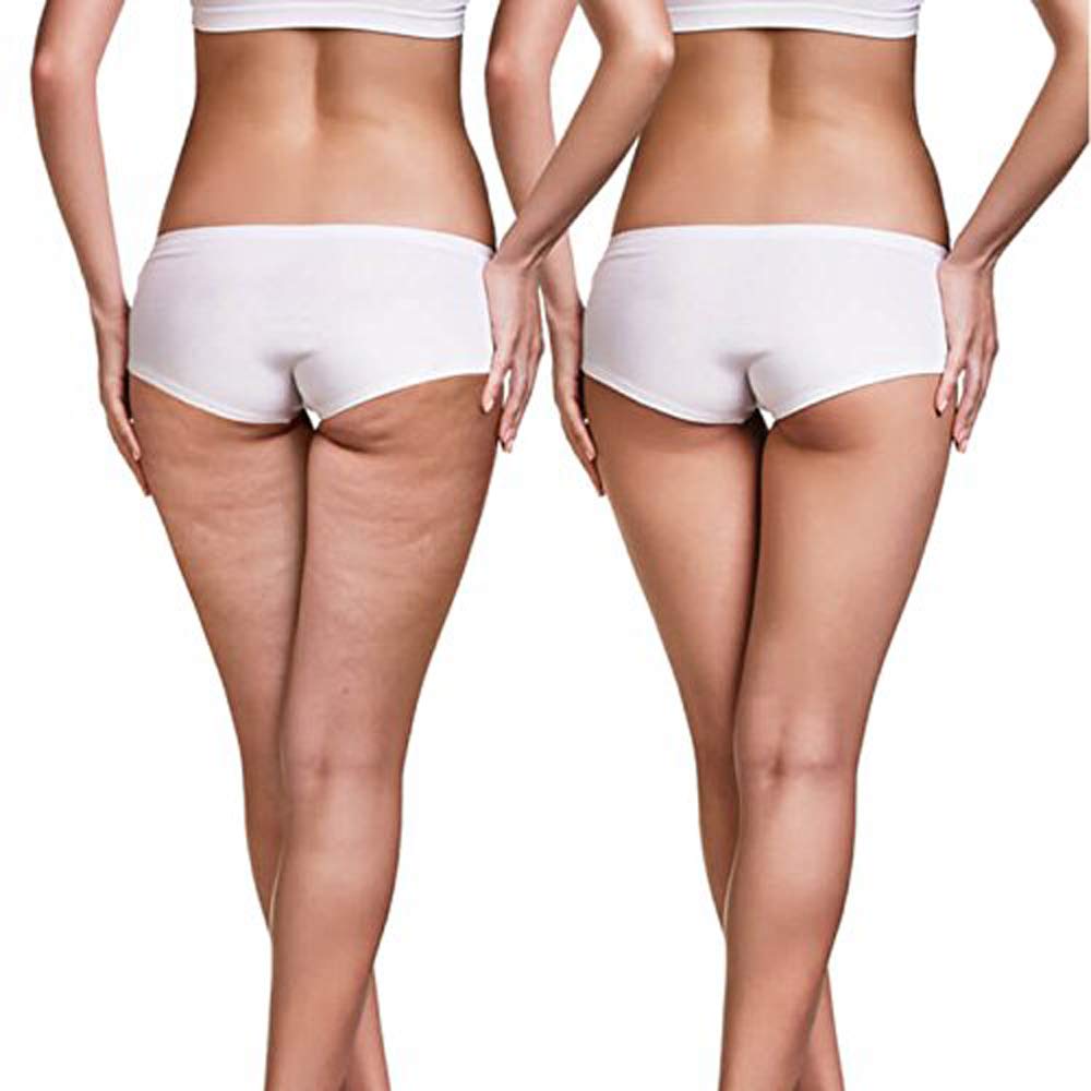 Gambe femminili con slip bianchi